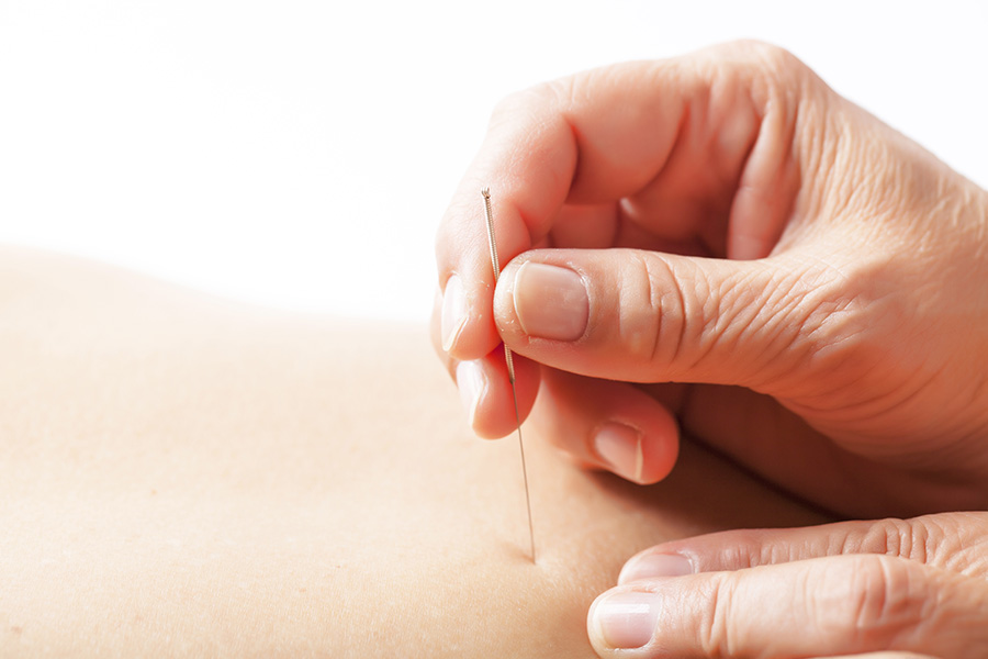 geburtsvorbereitende Akupunktur